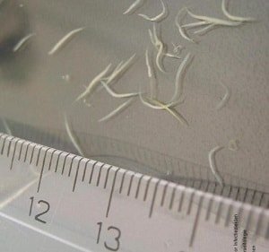 Глисты у детей: откуда и как эффективно бороться