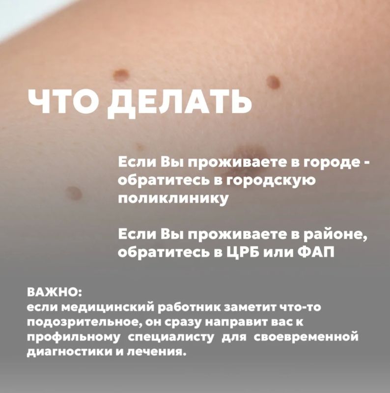 Что важно знать о меланоме? Что важно знать о меланоме?